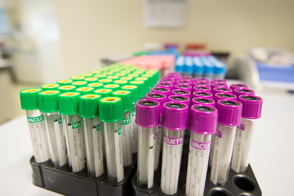 Bloedafname in het Gelre op afspraak