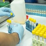 Gelre ziekenhuizen neemt laboratoriumactiviteiten CDG over