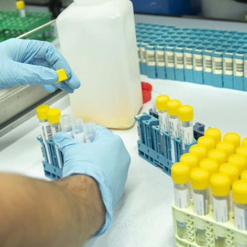 Gelre ziekenhuizen neemt laboratoriumactiviteiten Clinical Diagnostics Gelre over