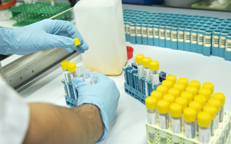 Gelre ziekenhuizen neemt laboratoriumactiviteiten Clinical Diagnostics Gelre over